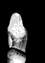 burndup