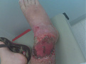 Click image for larger version

Name:	IMG00042-20100929-1433.jpg
Views:	289
Size:	45.4 KB
ID:	7134985