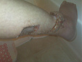 Click image for larger version

Name:	leggggg.jpg
Views:	258
Size:	37.2 KB
ID:	7134987